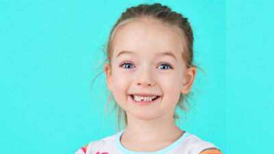 Çocukların sağlıklı gelişimi için süt dişlerinin önemi yadsınamaz. Ancak “Nasıl