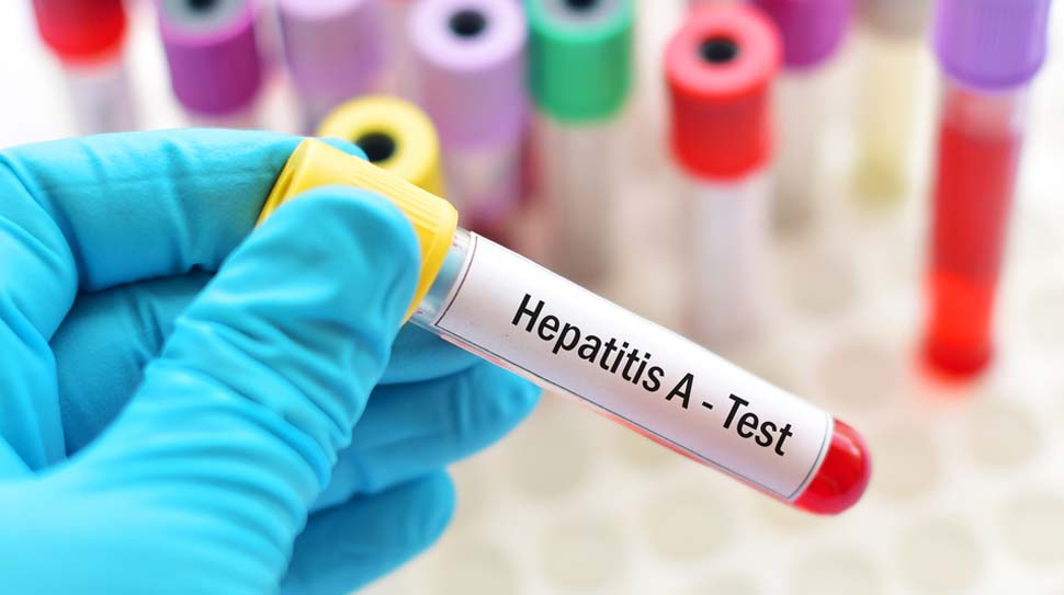 Hepatit A, Hepatit A virüsünün neden olduğu bir karaciğer enfeksiyonu