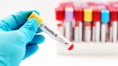 Hepatit B, ciddi bir karaciğer hastalığı. Ücretsiz aşılar ve erken